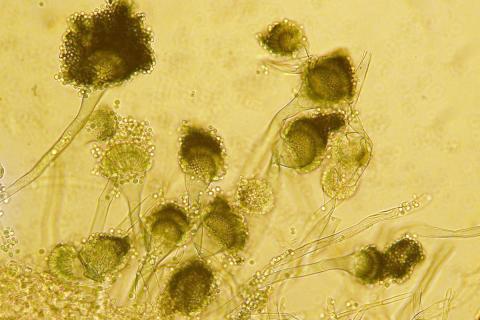 Gróberar súlufruggu, Aspergillus fumigatus, séðir í smásjá